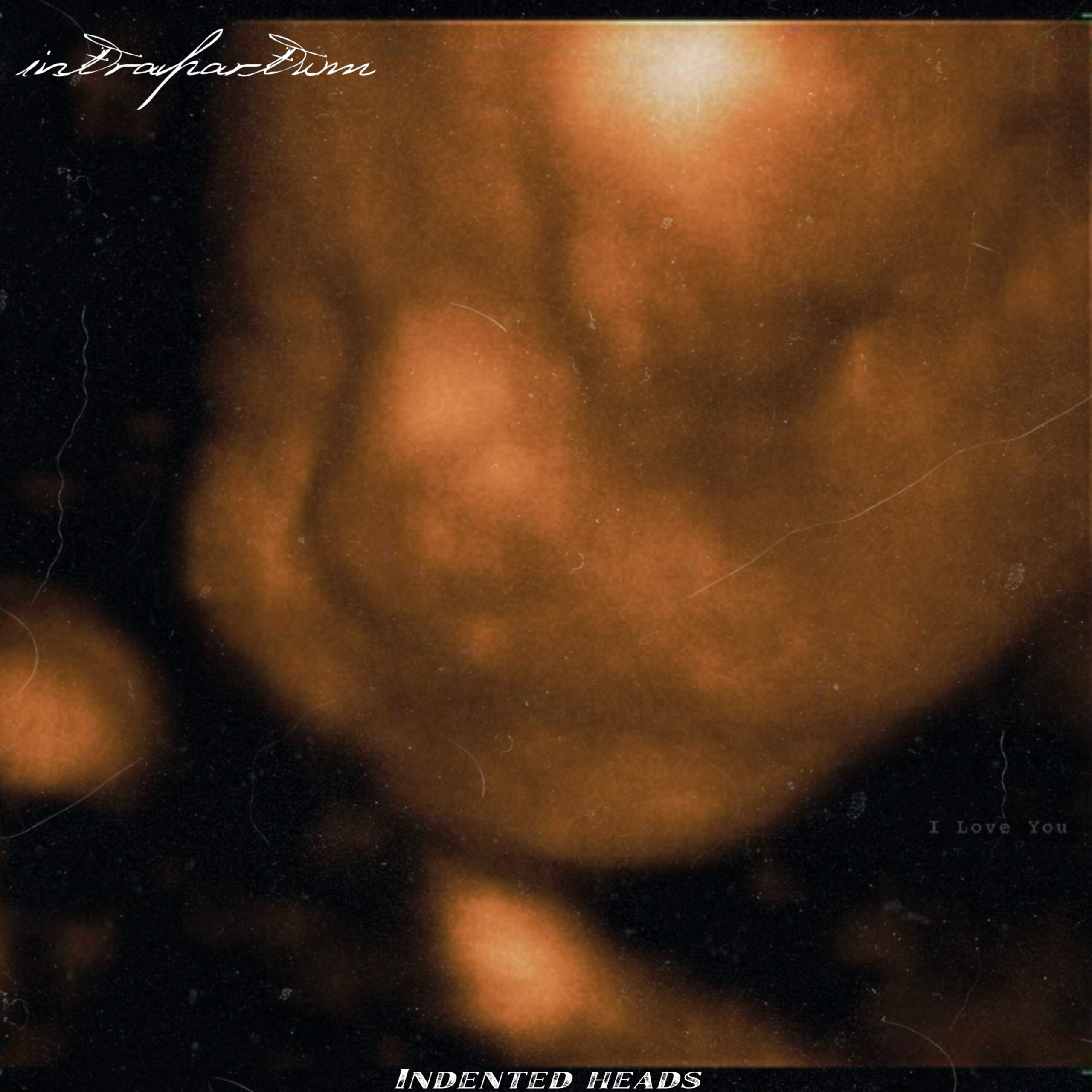 Intrapartum by Indented Heads